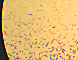 Gram-stained bacteria